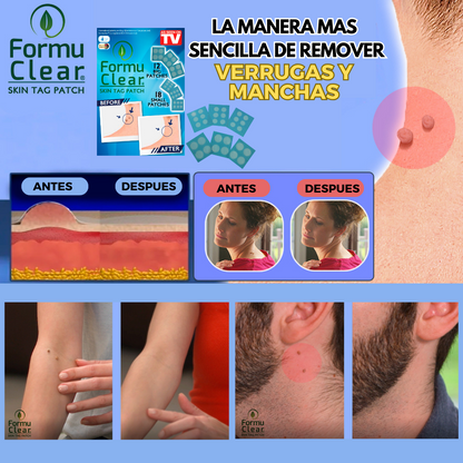 ELIMINA VERRUGASFormu Clear Skin Tag