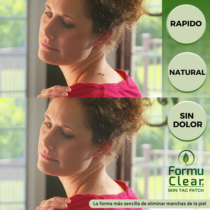 ELIMINA VERRUGASFormu Clear Skin Tag